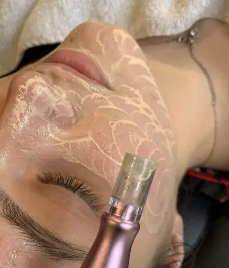 microneedling bb glow soin visage