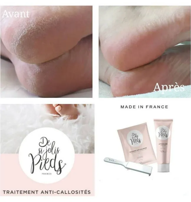 pedicure yumi feet pied pieds